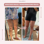 Cellumove 3D Legging – Despídete del dolor y la fatiga del lipoedema de forma natural