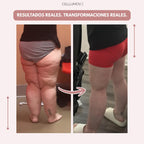 Cellumove 3D Legging – Despídete del dolor y la fatiga del lipoedema de forma natural