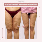 Cellumove 3D Legging – Despídete del dolor y la fatiga del lipoedema de forma natural